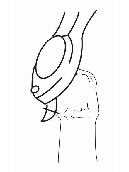 فتاحة زجاجات من Ibili – عملية وأنيقة