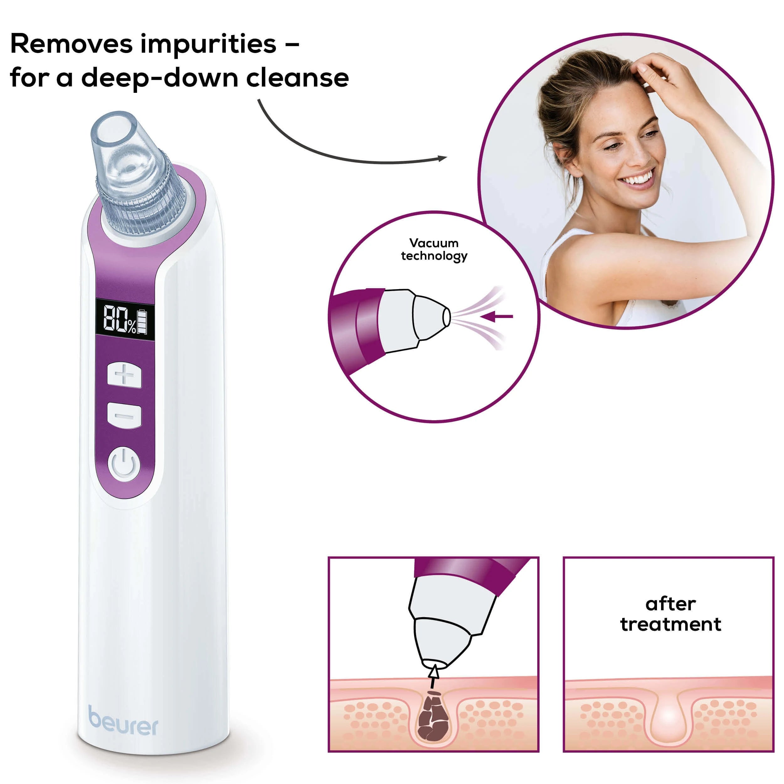 Beurer FC 41 Pore Cleaner Deep Cleansing & Vacuum Technology