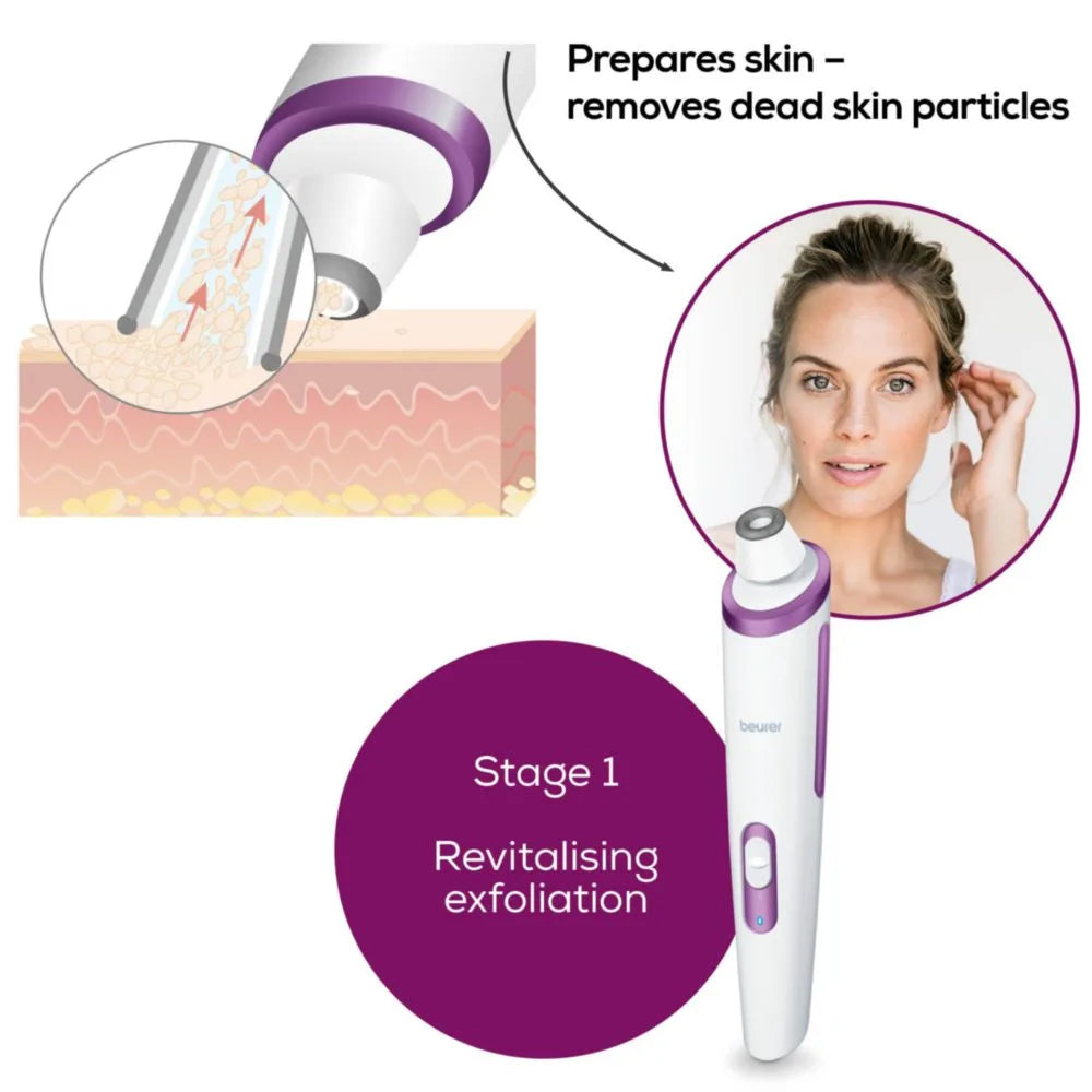 Beurer FC 76 Microdermabrasion Skin Peeling Device for Home Use