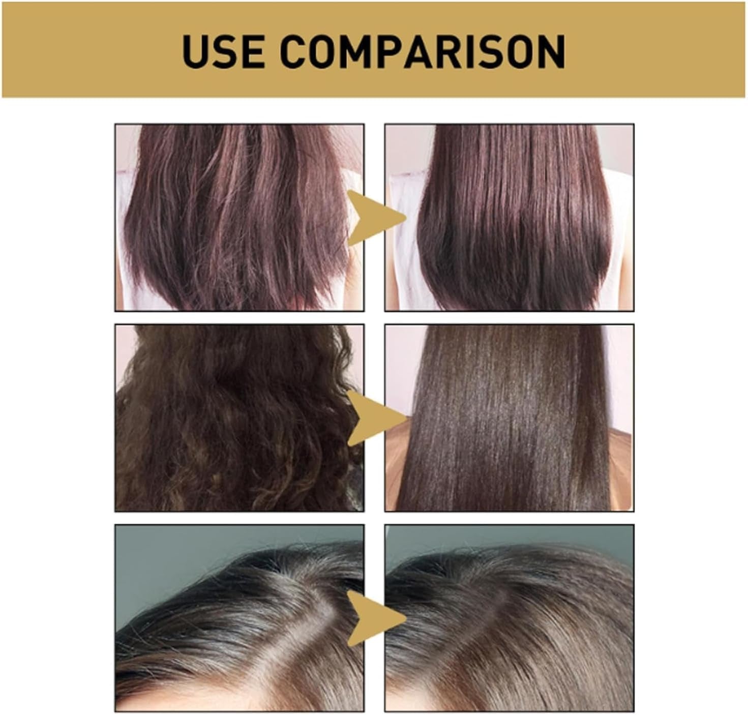 Sakura Japanese Shampoo for Hair Growth, Anti-Hair Loss & Anti-Dandruff - 300ml