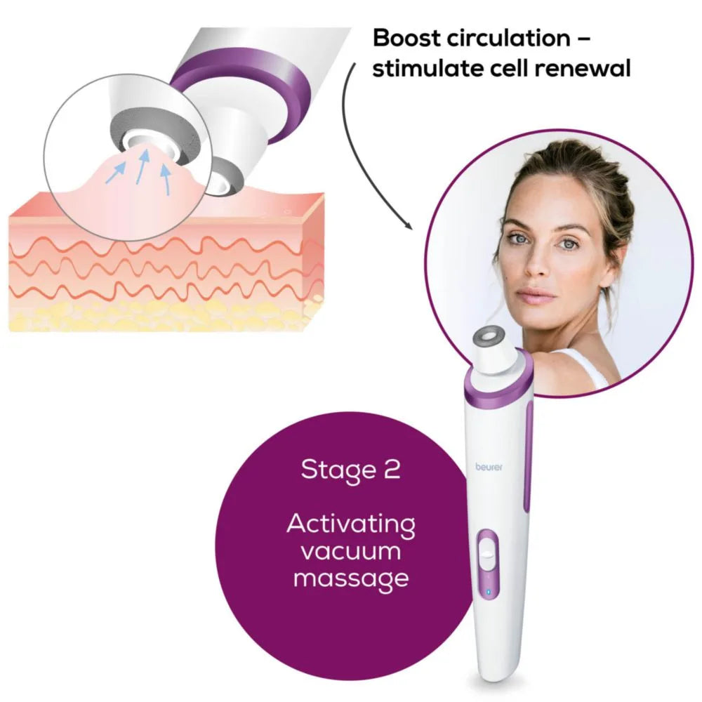 Beurer FC 76 Microdermabrasion Skin Peeling Device for Home Use